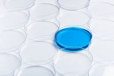 人白介素8(IL-8)酶聯(lián)免疫elisa試劑盒生產(chǎn)廠家